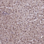 Immunohistochemical staining of human liver shows weak nuclear positivity in hepatocytes.