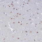 Immunohistochemical staining of human cerebral cortex shows moderate to strong nuclear positivity in neurons.