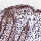 Immunohistochemical staining of human colon shows moderate to strong nuclear positivity in glandular cells.