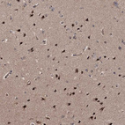 Immunohistochemical staining of human Cerebral cortex shows strong positivity in nucleoli in neuronal and glial cells.