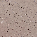 Immunohistochemical staining of human Cerebral cortex shows strong positivity in nucleoli in neuronal and glial cells.