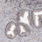 Immunohistochemical staining of human Prostate shows moderate positivity in nucleoli in glandular cells.