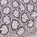 Immunohistochemical staining of human Rectum shows moderate positivity in nucleoli in glandular cells.