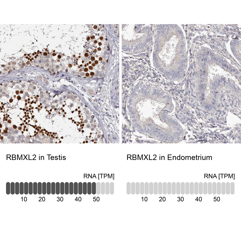 Anti-RBMXL2 Antibody