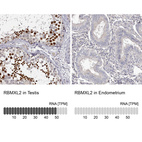 Anti-RBMXL2 Antibody