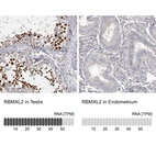 Anti-RBMXL2 Antibody
