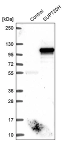 Western blot analysis in control (vector only transfected HEK293T lysate) and SUPT20H over-expression lysate (Co-expressed with a C-terminal myc-DDK tag (~3.1 kDa) in mammalian HEK293T cells, LY423050).