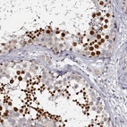 Immunohistochemical staining of human testis shows high expression.