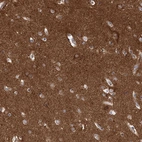 Immunohistochemical staining of human cerebral cortex shows moderate to strong positivity in neuropil.