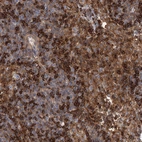 Immunohistochemical staining of human lymph node shows moderate to strong cytoplasmic positivity in lymphoid cells.