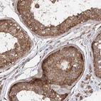 Immunohistochemical staining of human testis shows moderate to strong cytoplasmic positivity in cells in seminiferous ducts.