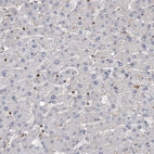 Immunohistochemical staining of human liver shows no cytoplasmic positivity in hepatocytes as expected.