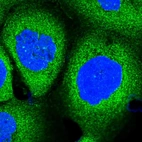 Immunofluorescent staining of human cell line A-431 shows localization to cytosol.