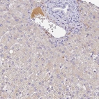 Anti-CFHR1 Antibody