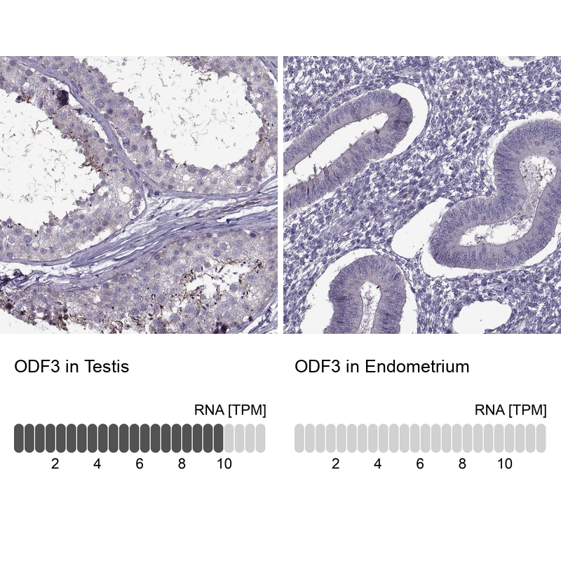 Anti-ODF3 Antibody