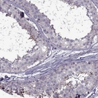 Immunohistochemical staining of human testis shows high expression.