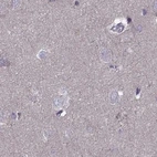 Immunohistochemical staining of human cerebral cortex using Anti-ODF3 antibody HPA038919.
