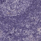Immunohistochemical staining of human lymph node using Anti-ODF3 antibody HPA038919.