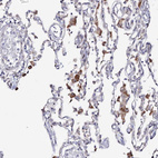 Immunohistochemical staining of human lung shows strong cytoplasmic positivity in macrophages.