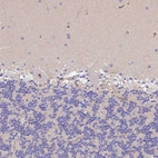 Immunohistochemical staining of human cerebellum shows no positivity in Purkinje cells as expected.