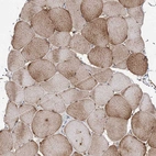 Immunohistochemical staining of human skeletal muscle shows moderate cytoplasmic positivity in myocytes.