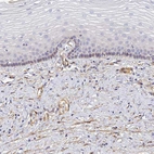 Immunohistochemical staining of human cervix shows no positivity in squamous epithelial cells as expected.
