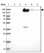 Lane 1: Marker [kDa] 250, 130, 95, 72, 55, 36, 28, 17, 10_br/_Lane 2: Human cell line RT-4_br/_Lane 3: Human cell line U-251MG sp_br/_Lane 4: Human plasma (IgG/HSA depleted)_br/_Lane 5: Human liver tissue_br/_Lane 6: Human tonsil tissue