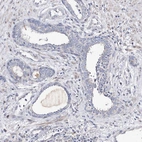 Immunohistochemical staining of human prostate shows negative to very weak positivity in glandular cells.