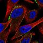 Immunofluorescent staining of human cell line U-251 MG shows localization to vesicles.