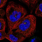 Immunofluorescent staining of human cell line A-431 shows localization to centrosome.