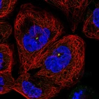 Immunofluorescent staining of human cell line A-431 shows localization to centrosome.