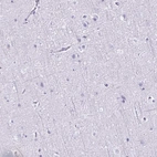 Immunohistochemical staining of human cerebral cortex shows low expression as expected.
