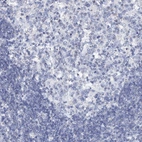 Immunohistochemical staining of human lymph node shows low expression as expected.