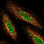 Immunofluorescent staining of human cell line HeLa shows localization to nucleoplasm & vesicles.
