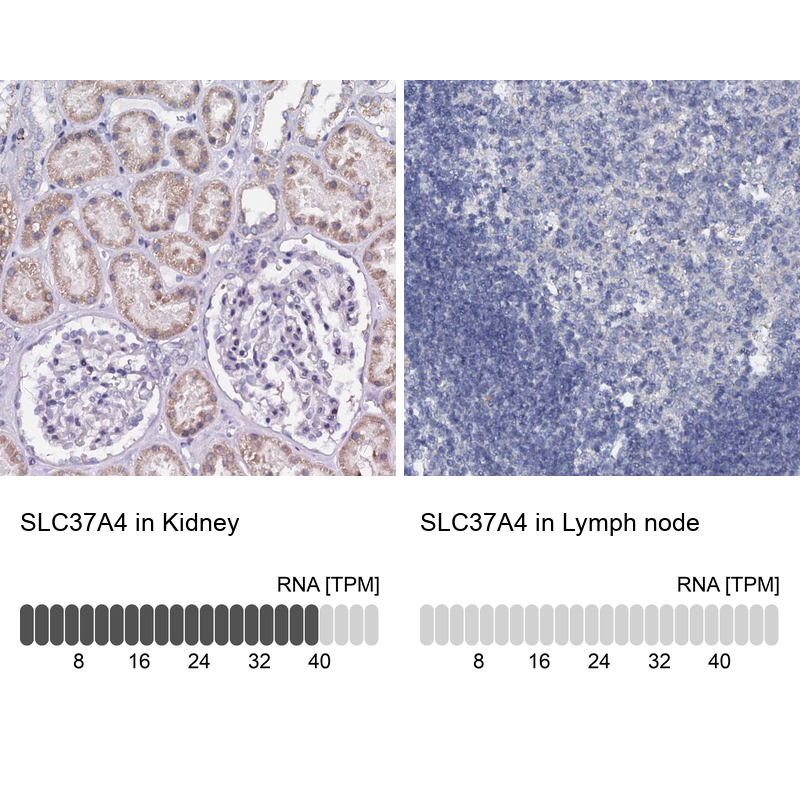 Anti-SLC37A4 Antibody