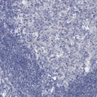 Immunohistochemical staining of human lymph node shows low expression as expected.