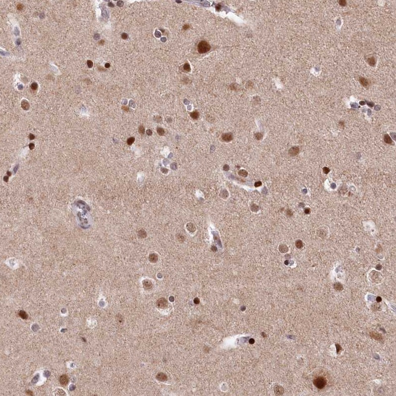 Anti-MCF2L2 Antibody