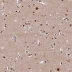 Anti-MCF2L2 Antibody