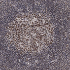 Anti-ZCCHC10 Antibody