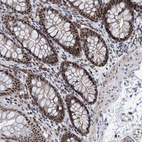 Immunohistochemical staining of human colon shows strong nuclear positivity in glandular cells.