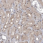 Immunohistochemical staining of human kidney shows moderate nuclear positivity in cells in tubules.
