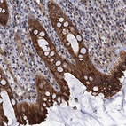 Anti-ABLIM1 Antibody