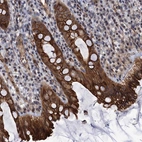 Anti-ABLIM1 Antibody