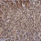Anti-MBD6 Antibody