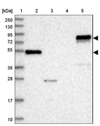 Lane 1: Marker [kDa] 250, 130, 95, 72, 55, 36, 28, 17, 10_br/_Lane 2: Human cell line RT-4_br/_Lane 3: Human cell line U-251MG sp_br/_Lane 4: Human plasma (IgG/HSA depleted)_br/_Lane 5: Human liver tissue