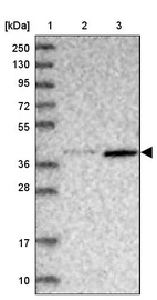 Anti-ABLIM1 Antibody