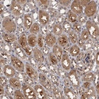 Anti-SNX15 Antibody