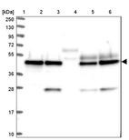 Lane 1: Marker [kDa] 250, 130, 95, 72, 55, 36, 28, 17, 10_br/_Lane 2: Human cell line RT-4_br/_Lane 3: Human cell line U-251MG sp_br/_Lane 4: Human plasma (IgG/HSA depleted)_br/_Lane 5: Human liver tissue_br/_Lane 6: Human tonsil tissue