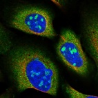 Immunofluorescent staining of human cell line U-2 OS shows localization to nucleoli & cytosol.