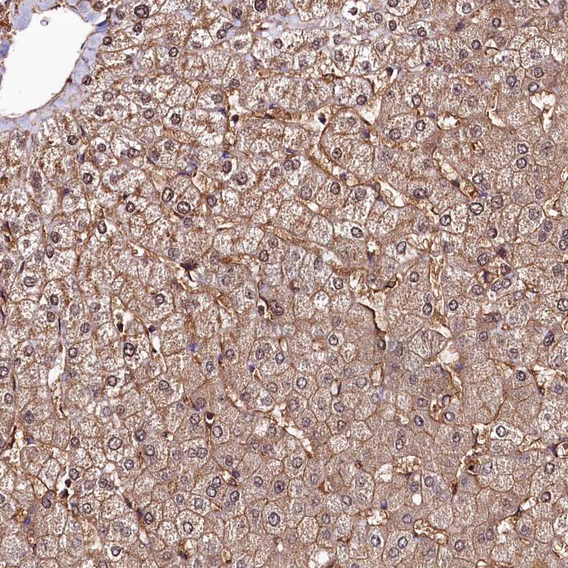 Anti-ANO6 Antibody